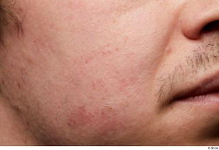 HD Skin Brandon Davis cheek face head mustache skin pores…